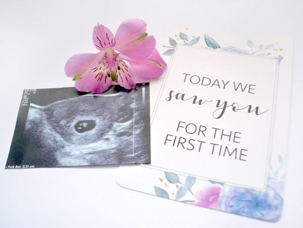 Pregnancy and IVF Milestone Cards - Florals